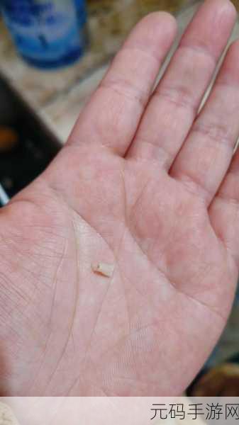 臭小子姨妈腰快断了:1. 臭小子的姨妈:腰痛背后的故事