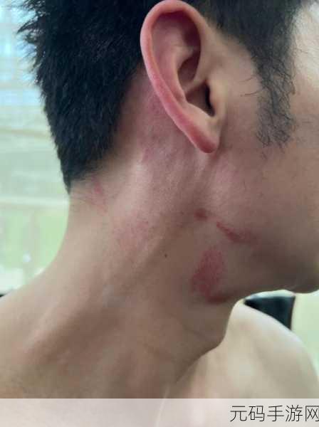 吻痕（1v1，h）情感对决：1. 《深情吻痕：爱与欲的对决