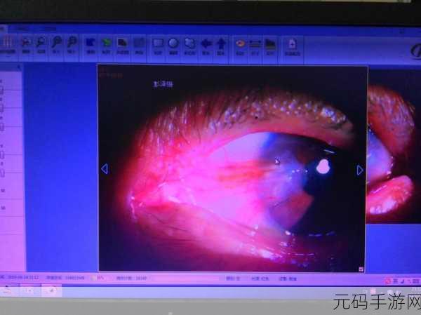 获得超级胬肉系统母亲：探索超级胬肉系统：母亲角色的全新拓展