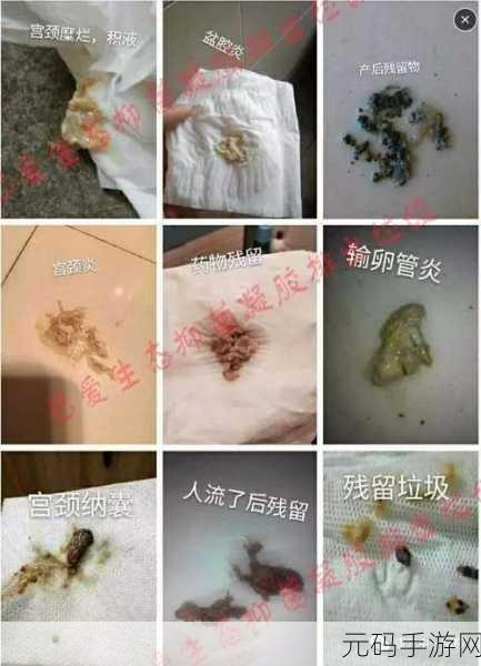 老中医给雨萱排阴毒：1. 老中医教你如何排除体内阴毒