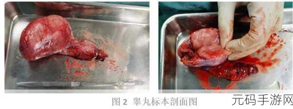 但是睾丸被注入了高浓缩药剂：1. 注射高浓缩药剂后的睾丸变异研究